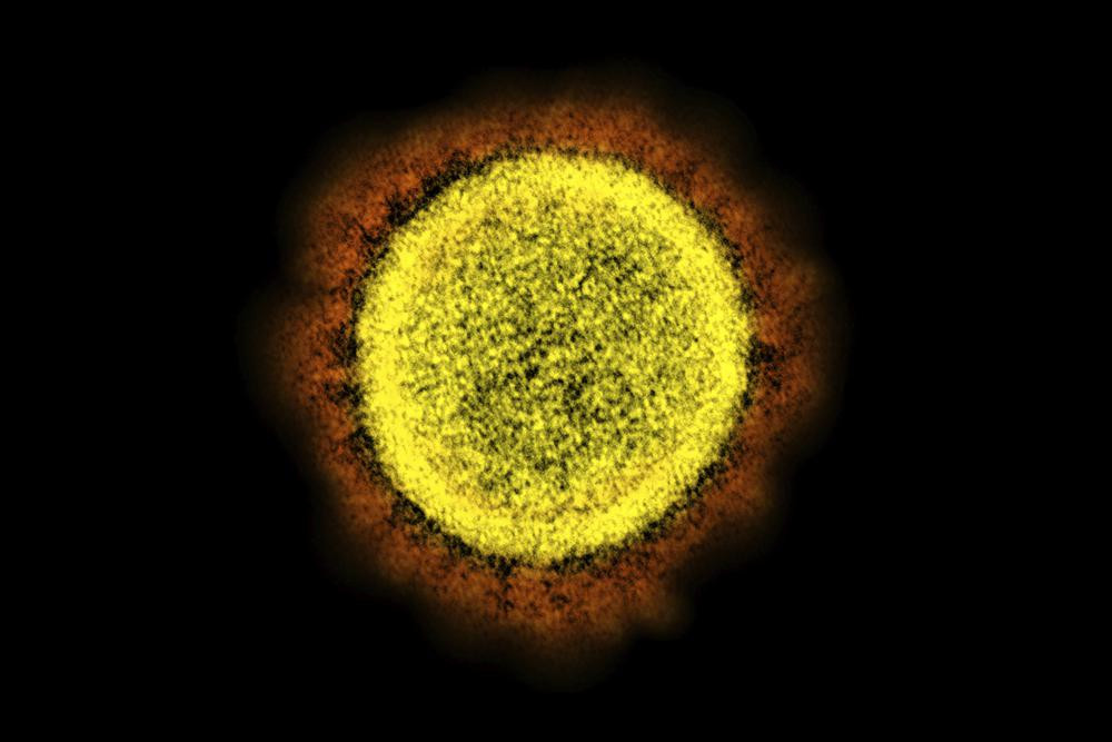 This 2020 electron microscope image made available by the National Institute of Allergy and Infectious Diseases shows a Novel Coronavirus SARS-CoV-2 particle isolated from a patient, in a lab