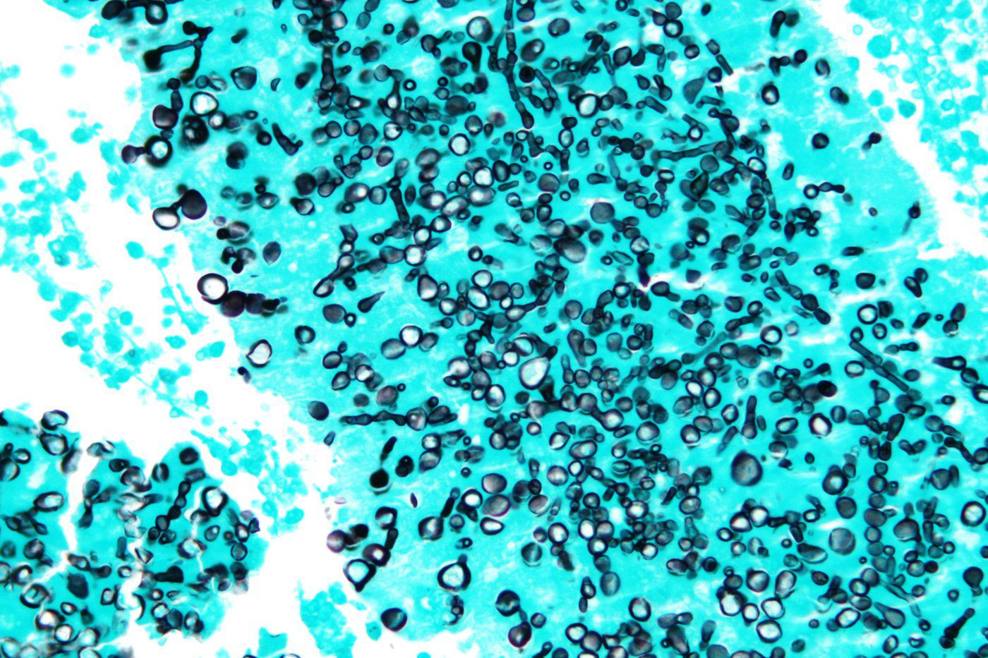 Valley fever is commonly found in soil. (Nephron, Wikimedia Commons)