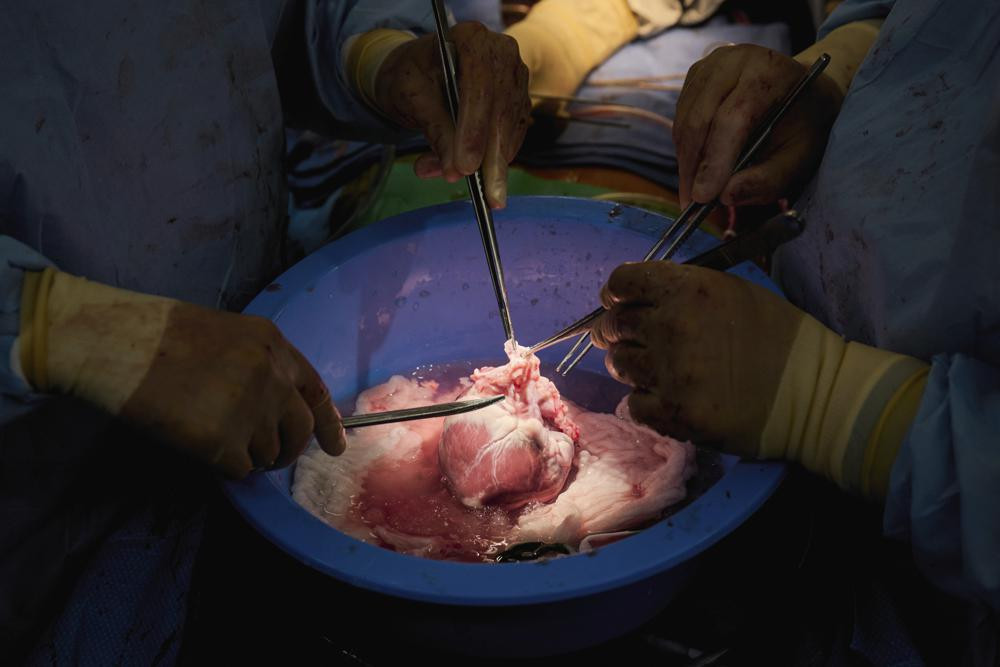 In this photo provided by NYU Langone Health, surgeons prepare a genetically modified pig heart for transplant into a recently deceased donor at NYU Langone Health on July 6, 2022, in New Yor
