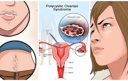 Sketch: fitnessadvise.net