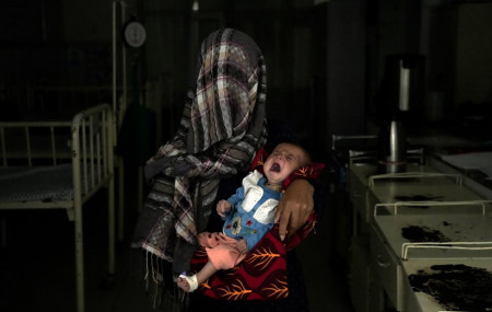 Nazia 30, who has lost four children due to severe malnutrition, holds her malnourished baby in a hospital in Parwan province north of Kabul, Afghanistan, Thursday, May 19, 2022.